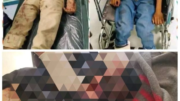 المليشيات الحوثية الإرهابية تواصل استهداف المدنيين في المنافذ والمناطق الحدودية 