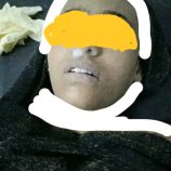 مأساة على شاطئ جولدمور.. العثور على جثة فتاة في مقتبل العمر «صورة