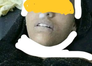 مأساة على شاطئ جولدمور.. العثور على جثة فتاة في مقتبل العمر «صورة