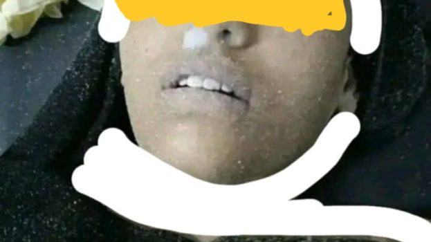 مأساة على شاطئ جولدمور.. العثور على جثة فتاة في مقتبل العمر «صورة