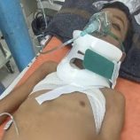 إرهاب حوثي جديد يستهدف الطفولة.. إصابة خطيرة لطفل برصاص قناص في كرش 
