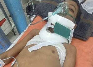 إرهاب حوثي جديد يستهدف الطفولة.. إصابة خطيرة لطفل برصاص قناص في كرش 