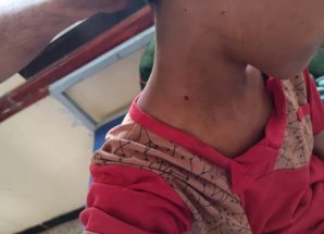 مليشيا الحوثي الإرهابية تستهدف طفلًا بطلق ناري في كرش 